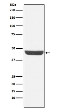 NDRG1 Rabbit Monoclonal Antibody