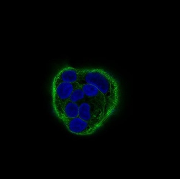 Cytokeratin 18 KRT18 Rabbit Monoclonal Antibody