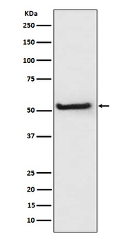 TXNIP Rabbit Monoclonal Antibody
