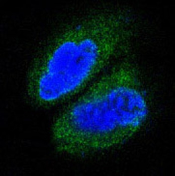 MAP3K7 Rabbit Monoclonal Antibody
