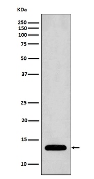 Profilin1/PFN1 Rabbit Monoclonal Antibody