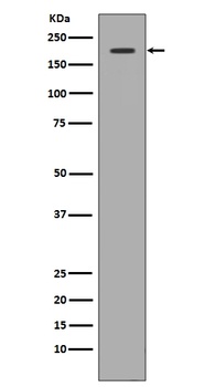 Met Rabbit Monoclonal Antibody