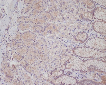 Met Rabbit Monoclonal Antibody