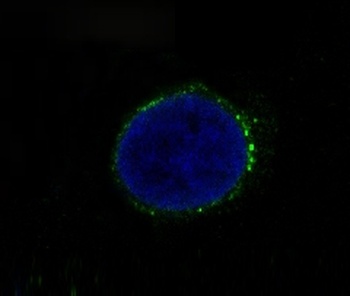 Met Rabbit Monoclonal Antibody