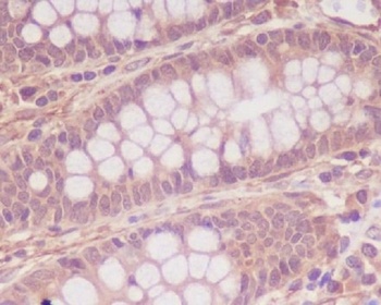 Myosin light chain kinase MYLK Rabbit Monoclonal Antibody