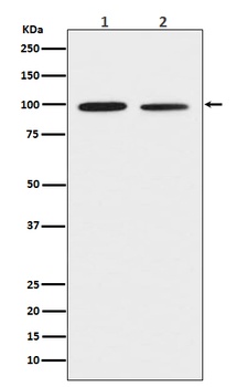 DDR2 Rabbit Monoclonal Antibody