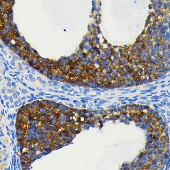 BIRC2 Rabbit Monoclonal Antibody