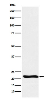 GLO1 Rabbit Monoclonal Antibody
