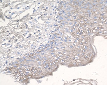 CCR3 Rabbit Monoclonal Antibody