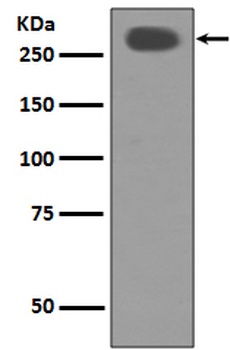 Acetyl-CoA Carboxylase Rabbit Monoclonal Antibody