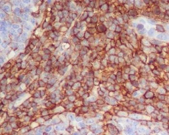 CD90/Thy1 Rabbit Monoclonal Antibody