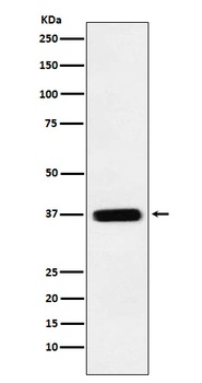 TMEM173 Rabbit Monoclonal Antibody
