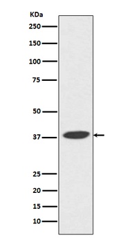 DNA Polymerase beta Rabbit Monoclonal Antibody