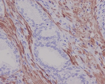Desmin Rabbit Monoclonal Antibody