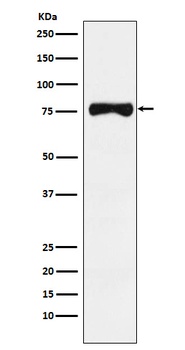 TRP1 Rabbit Monoclonal Antibody
