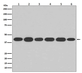 Actin ACTA1 Rabbit Monoclonal Antibody
