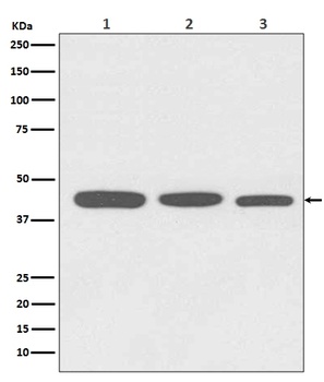 Actin ACTA1 Rabbit Monoclonal Antibody