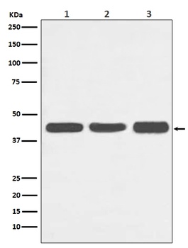 Actin ACTA1 Rabbit Monoclonal Antibody