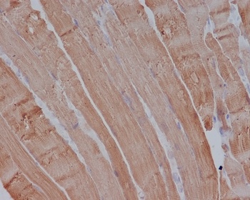 Actin ACTA1 Rabbit Monoclonal Antibody