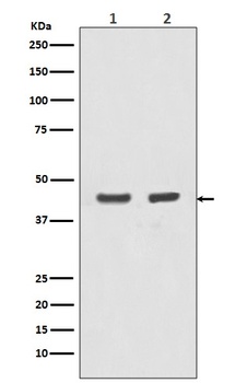 Actin ACTA1 Rabbit Monoclonal Antibody