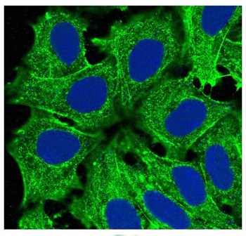 Actin ACTA1 Rabbit Monoclonal Antibody