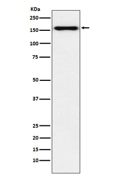 Desmoglein 2 Rabbit Monoclonal Antibody