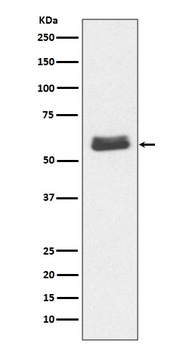 Caspase-10/10 Rabbit Monoclonal Antibody