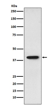 SET Rabbit Monoclonal Antibody