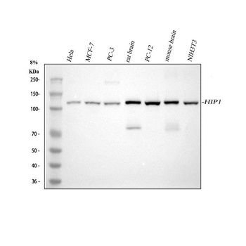 HIP1 Rabbit Monoclonal Antibody