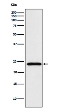 Mad2L2 Rabbit Monoclonal Antibody