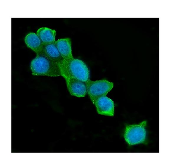 ATP citrate lyase ACLY Mouse Monoclonal Antibody
