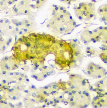 ATP citrate lyase ACLY Mouse Monoclonal Antibody