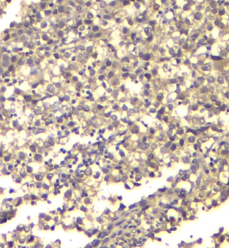 ATP citrate lyase ACLY Mouse Monoclonal Antibody