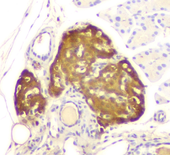 ATP citrate lyase ACLY Mouse Monoclonal Antibody