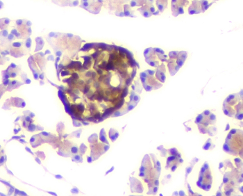 ATP citrate lyase ACLY Mouse Monoclonal Antibody