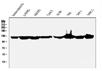 ATP citrate lyase ACLY Mouse Monoclonal Antibody