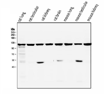 ATP citrate lyase ACLY Mouse Monoclonal Antibody