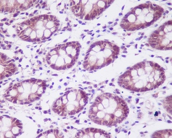 CKII alpha CSNK2A1 Rabbit Monoclonal Antibody