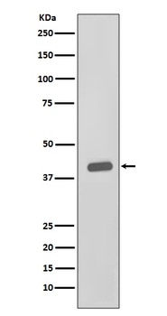 CKII alpha CSNK2A1 Rabbit Monoclonal Antibody