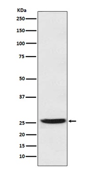 PGDH Rabbit Monoclonal Antibody
