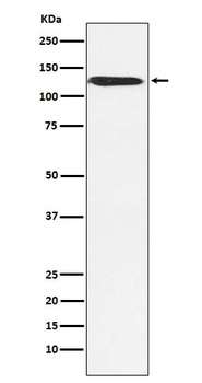 SNF2H SMARCA5 Rabbit Monoclonal Antibody