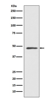 MEK7 MAP2K7 Rabbit Monoclonal Antibody