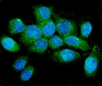 NMI Mouse Monoclonal Antibody