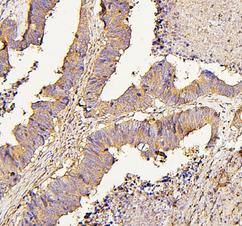 NMI Mouse Monoclonal Antibody