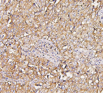 NMI Mouse Monoclonal Antibody