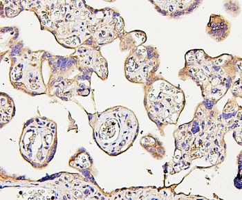 NMI Mouse Monoclonal Antibody
