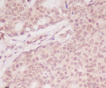 ATF5 Rabbit Monoclonal Antibody