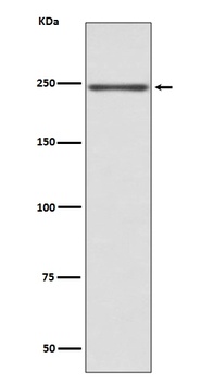 Myosin heavy chain MYH6 Rabbit Monoclonal Antibody