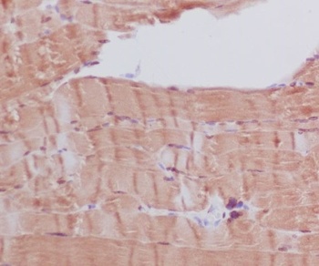 Myosin heavy chain MYH6 Rabbit Monoclonal Antibody