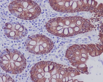 Cytokeratin 20 KRT20 Rabbit Monoclonal Antibody